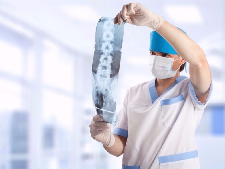 medicul se uită la un instantaneu al coloanei cervicale cu osteocondroză