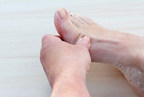 artroza piciorului