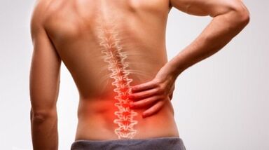 Semne și simptome ale osteochondrozei coloanei vertebrale lombare