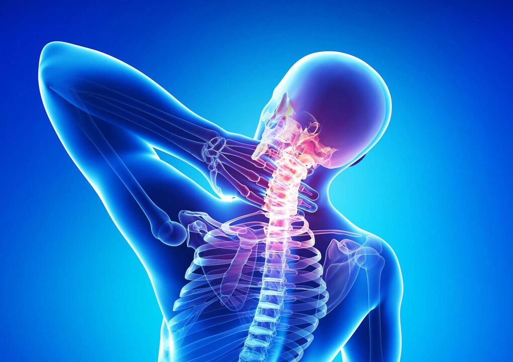 Osteochondroza gâtului