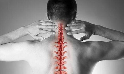 Cum se manifestă osteocondroza coloanei cervicale