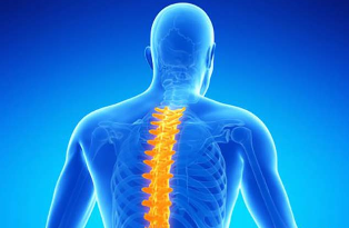 durere severă la nivelul coloanei vertebrale sacrale)
