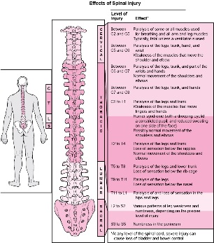 boli în organism asociate cu deteriorarea diverselor părți ale coloanei vertebrale