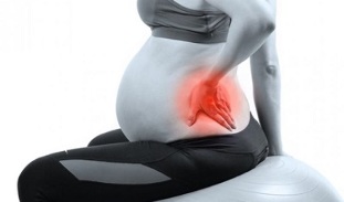 dureri de spate în timpul sarcinii